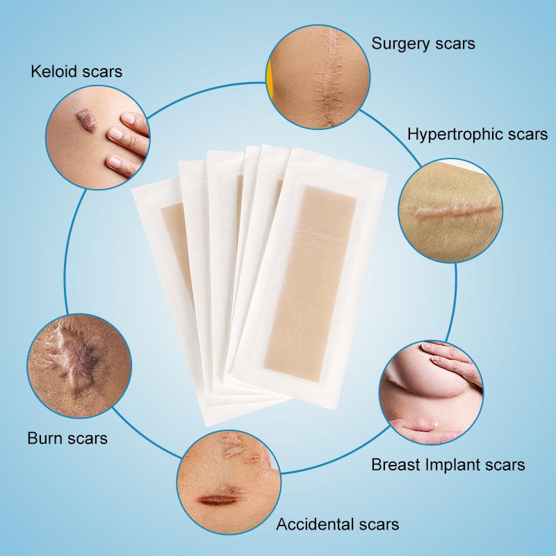 Medical Grade Adhesive Breathable Silicone Scar Removal Patch Factory Skin Color Waterproof for Scar Transparent Wound Dressings